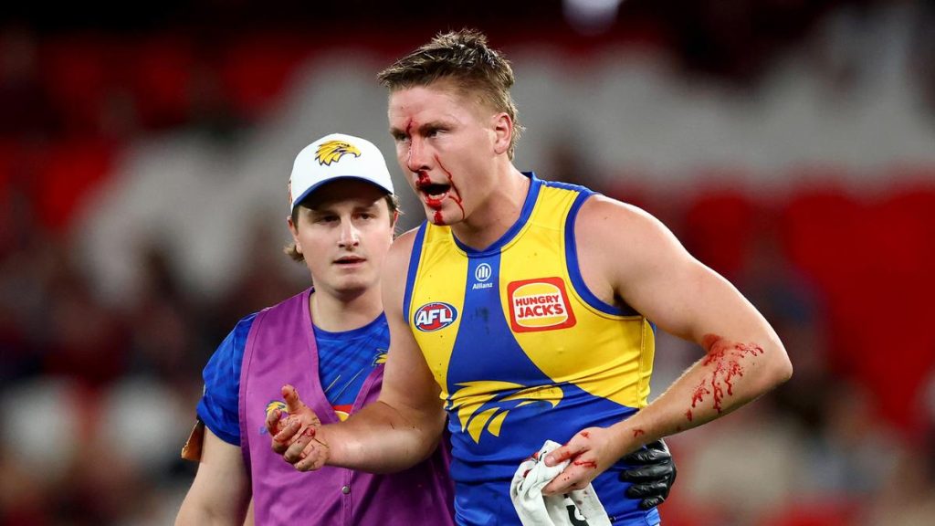 West Coast Eagles defender Harry Edwards suffers gruesome injury on comeback from concussion