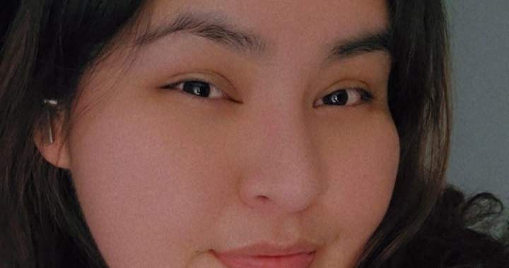 Family of woman who died in e-scooter accident pleads for riders to wear helmets – BC