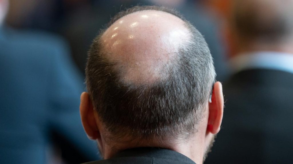 Gary Martin: Hair today gone tomorrow when baldness claims another scalp